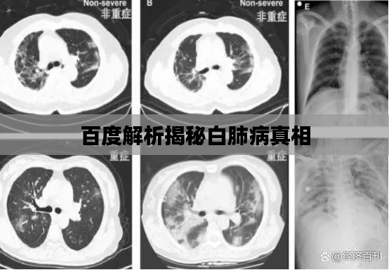百度解析揭秘白肺病真相